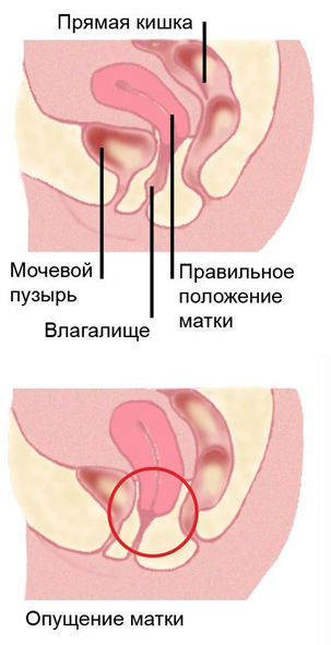 Влияние мата на здоровье, сознание