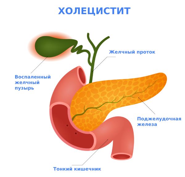 ≡ Лечение недержания мочи у женщин ᐈ